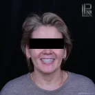 Клиника Стоматолог рядом на Старой Басманной улице Фотография 3