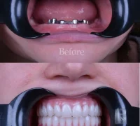 Клиника Стоматолог рядом на Старой Басманной улице Фотография 2